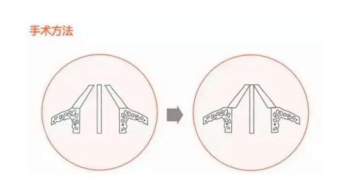 九院韦敏介绍,九院韦敏隆鼻多少钱