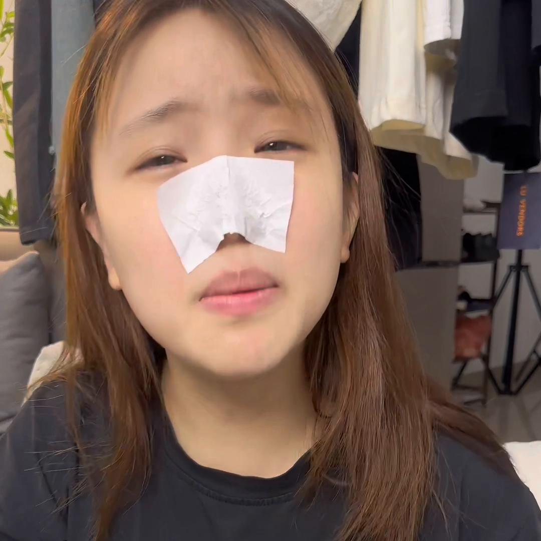 草莓鼻清理黑头神器大牌试用装,清理黑头草莓鼻最有效的方法