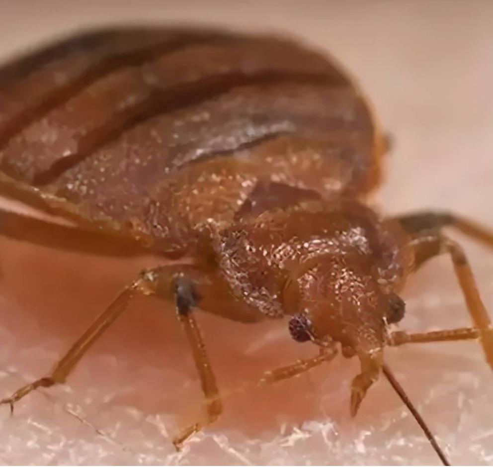 女子腹部痒，医生用镊子夹出16只阴虱！原来阴虱有4个传播途径