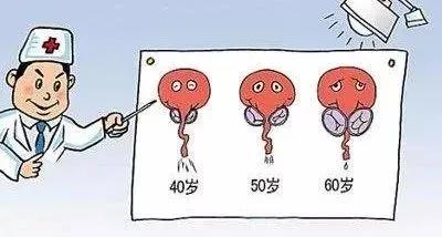 男性前列腺的常见问题,男性应警惕前列腺炎两个误区