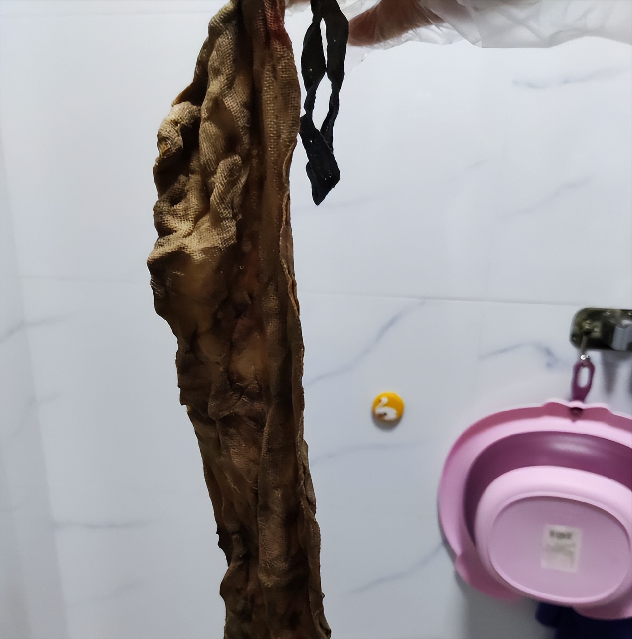 产妇体内遗留纱布,院方谈产妇体内留纱布