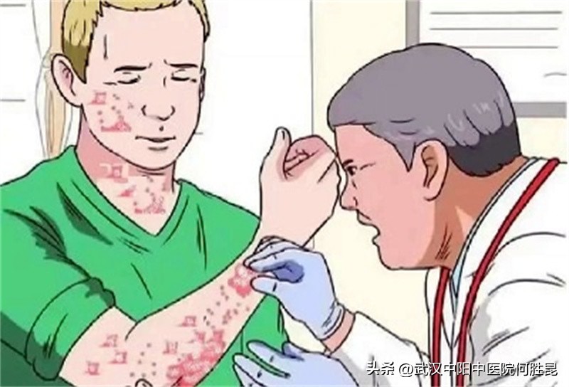 银屑病打生物制剂皮肤痒怎么办,银屑病脱皮后洗澡疼痒咋办