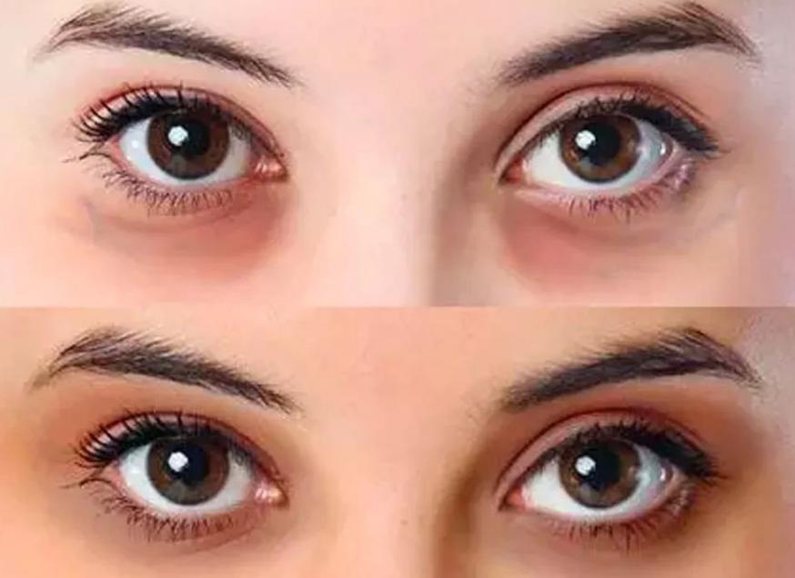 养肝护肝的药物和食物,养肝护肝的食物胡萝卜