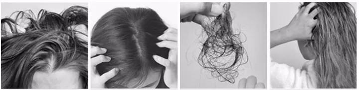 洗头不再用洗发水？用它轻松改善头皮屑，还不掉发！（湘村里）