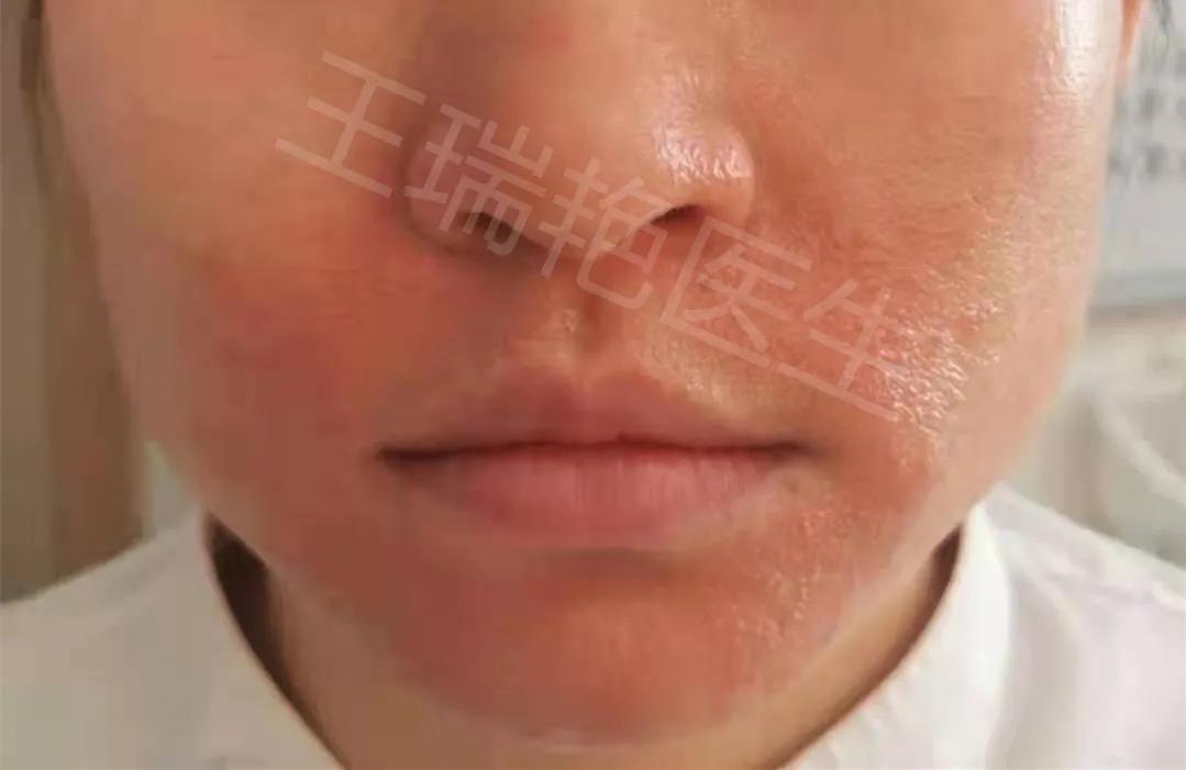 代购护肤品卖假货怎么办,代购购买的护肤品破损了