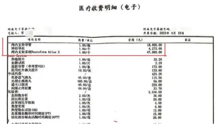 老人脑梗放支架,老人突发脑梗栽倒去世