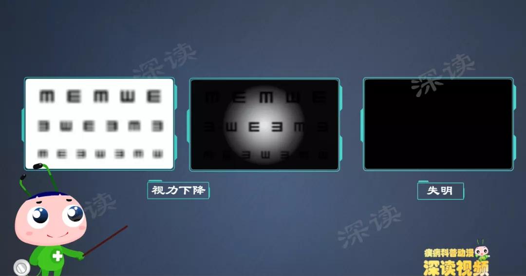 视物模糊？畏光流泪？细数第二大致盲眼病——青光眼致盲前啥征兆