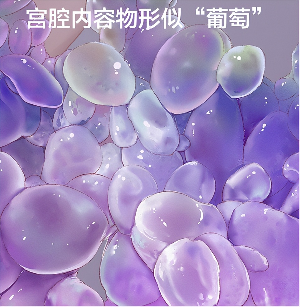 正常胎儿会变成葡萄吗,为什么我怀孩子一点感觉都没有呢