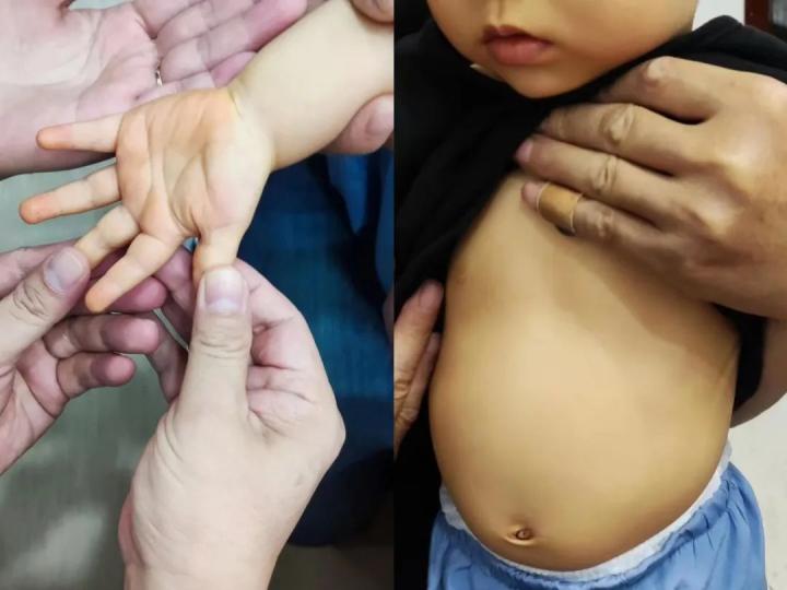 宝宝基因突变妈妈如何面对,宝宝基因突变是妈妈的原因吗