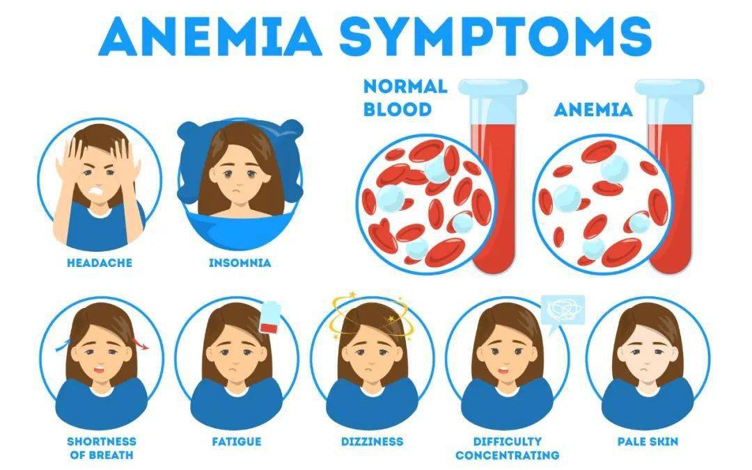 简述缺铁性贫血的饮食护理,缺铁性贫血的饮食指导建议