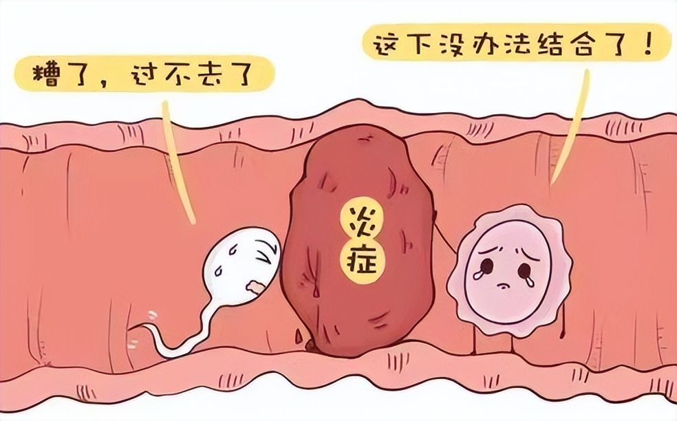 妇科病严重也怀孕了有影响吗,女性哪些妇科病会导致不孕