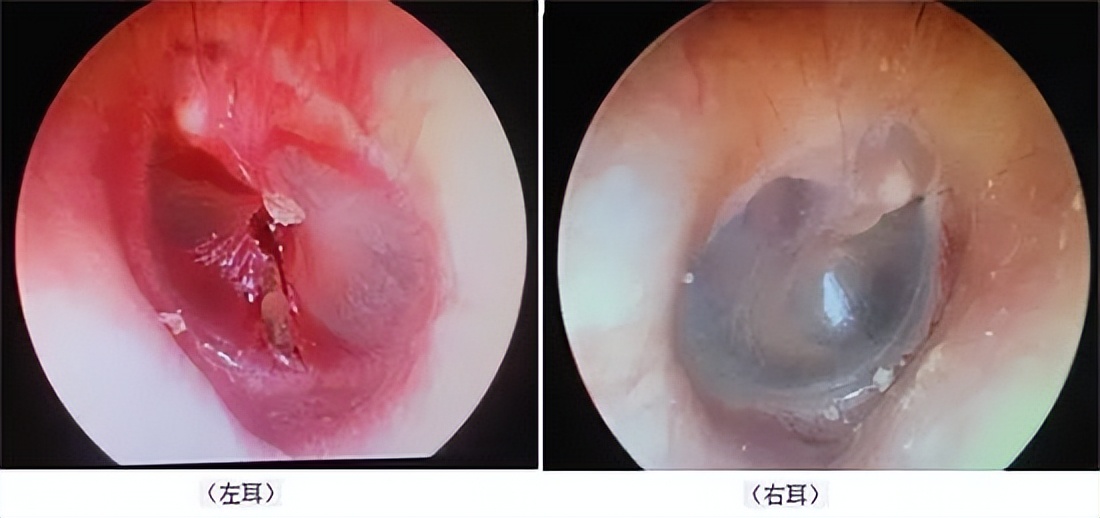 小石头学习视频,小石头学武术疼哭