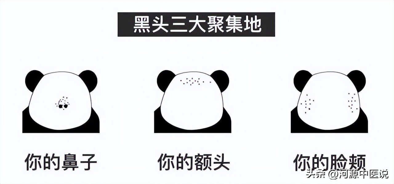 黑头处理皮肤科,黑头根除方法医美