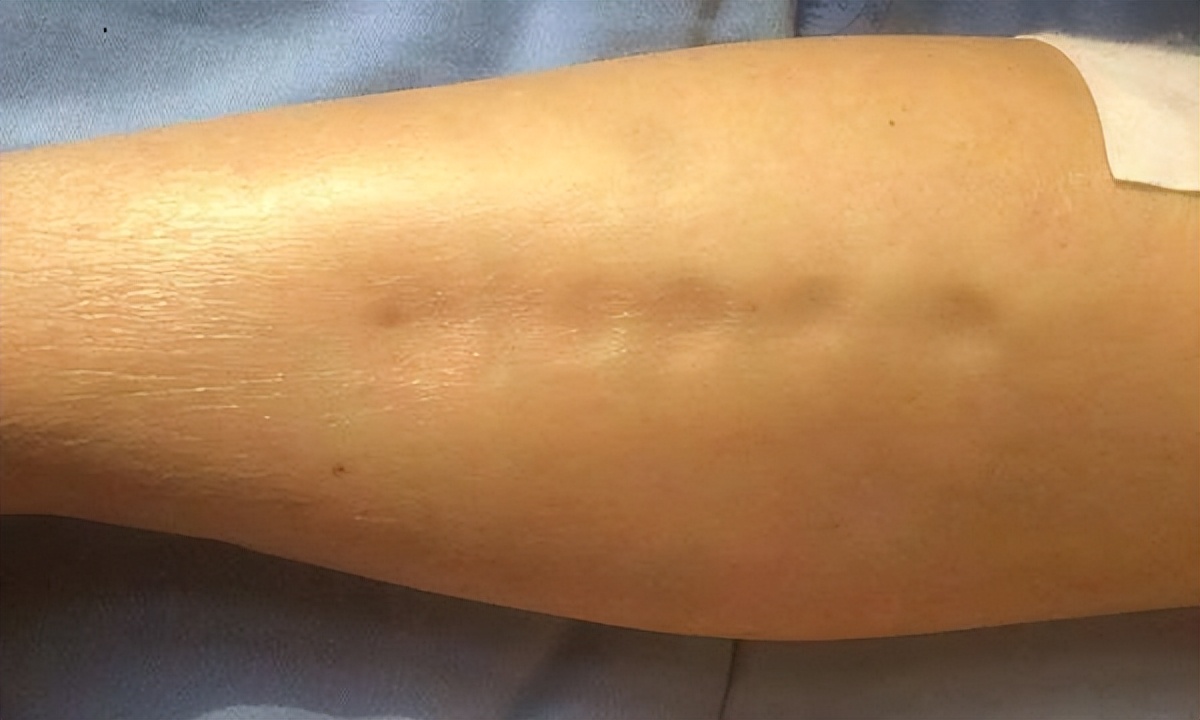 世卫组织公布「一级致癌物」名单,能不吃就不吃,别任性妄为!