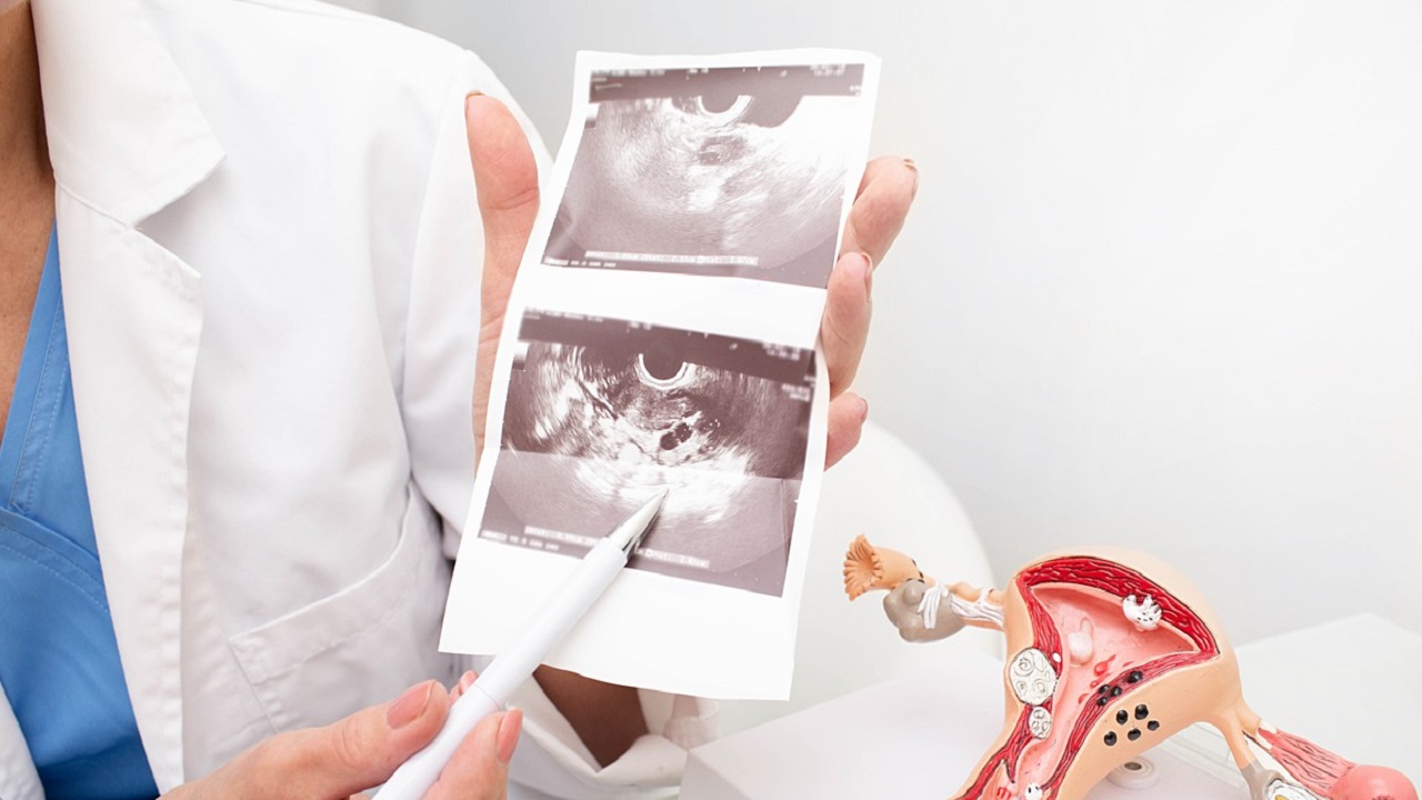 白带呈水样或者豆渣样,妇科白带水样带脓性怎么回事