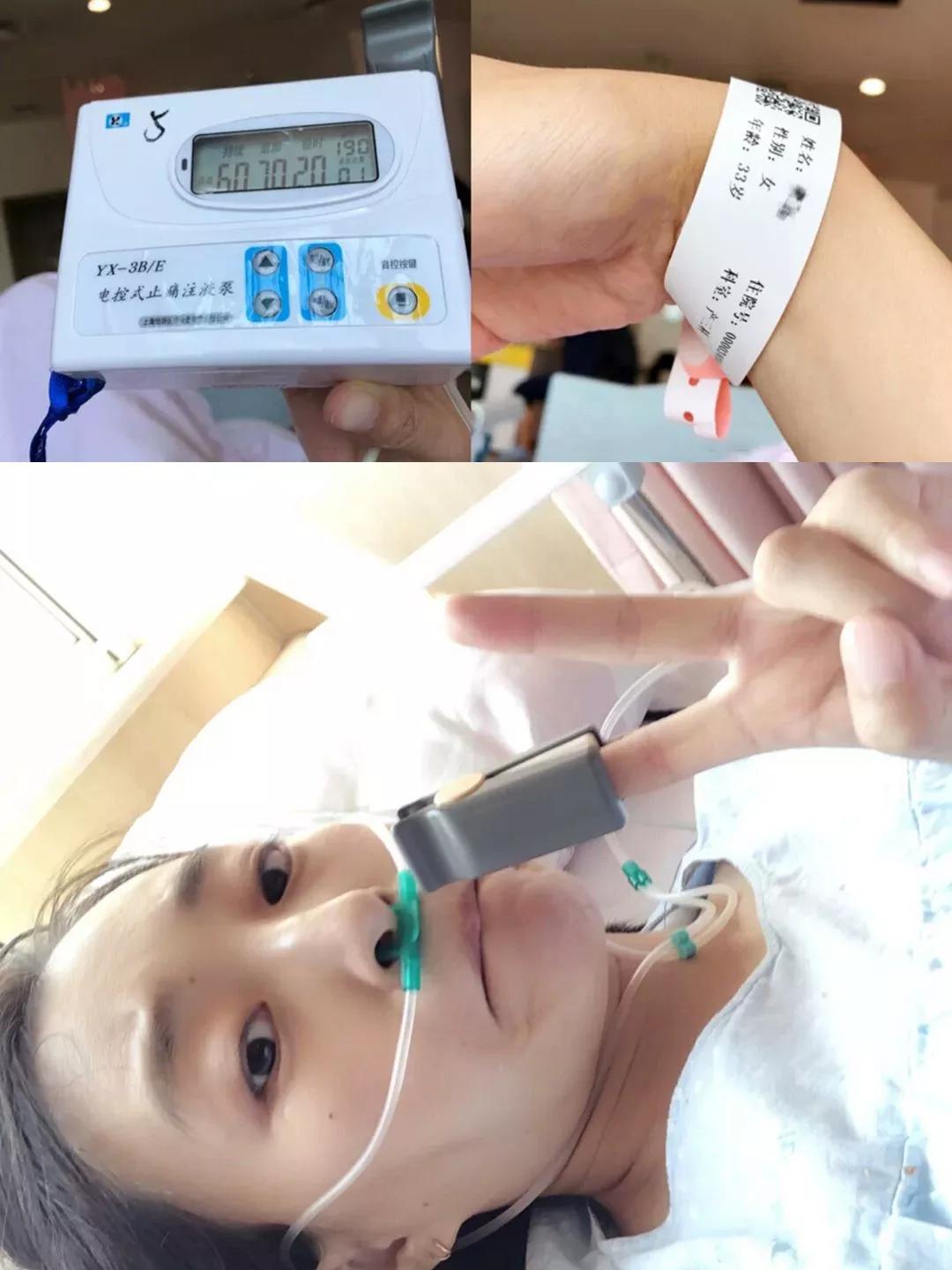 剖腹产后注意事项及技巧,剖腹产后肚子上的肉下垂怎么减掉