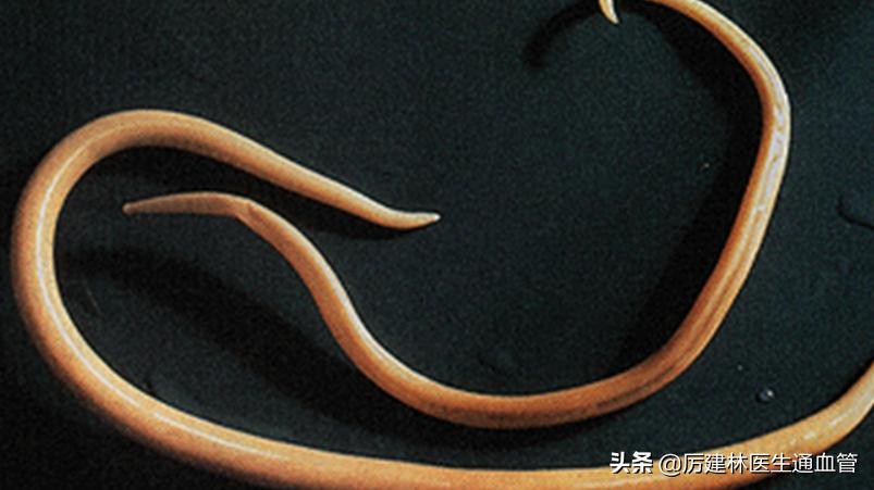 “除虫”十分有效的宝塔糖，为什么突然就消失了？