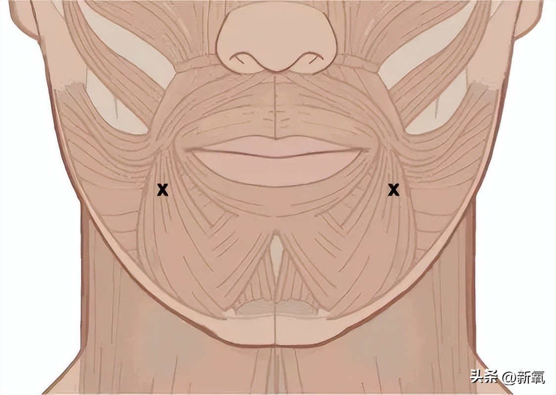 嘴唇薄变丰满,嘴唇变凸变丑怎么办