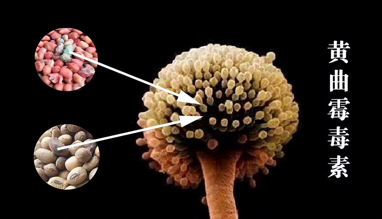 肝癌大户是什么,肝癌大户被揪出是烟酒的十倍