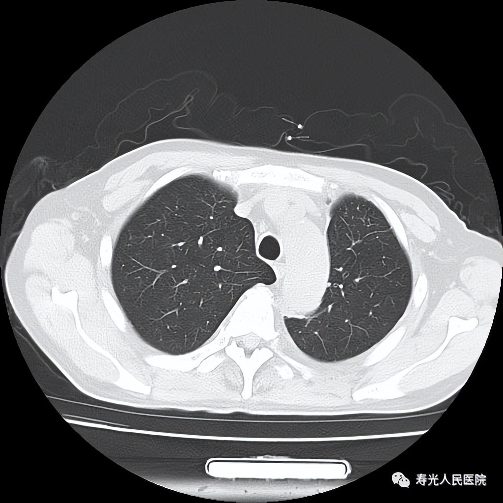 寿光人民医院呼吸与危重症一科,寿光人民医院住院的视频