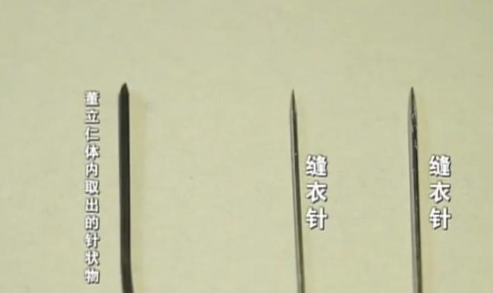 17岁男孩头痛被送进医院，医生一看X光片直接傻眼：没救了