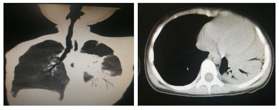 徐州市儿童医院呼吸二科,儿童呼吸介入科的设备