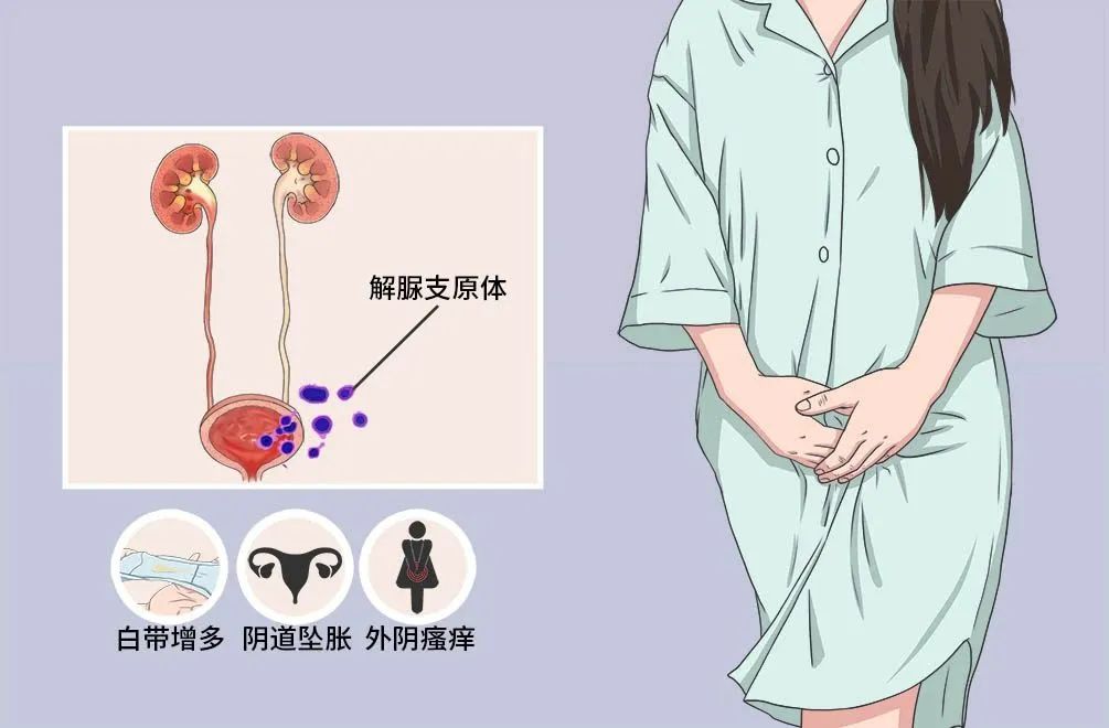 解脲支原体阳性是男的传给女的吗,解脲支原体阳性严重吗是艾滋病吗