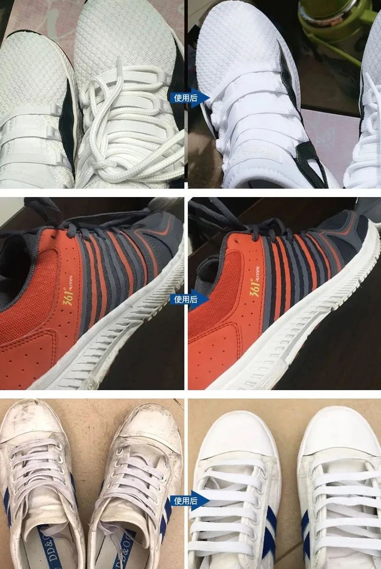 小白鞋脏了刷不下来有什么小妙招,小白鞋很脏怎么清洗没有白醋