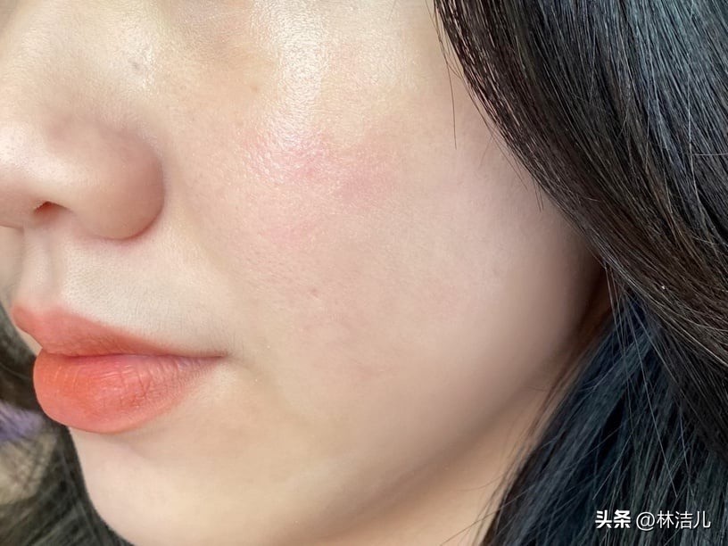 小棕瓶和小黑瓶祛痘,小棕瓶维稳抗老