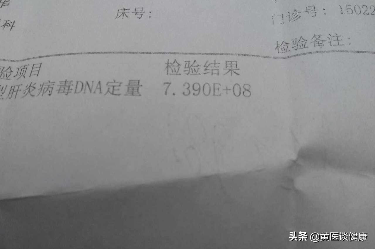 乙肝dna10的8次方能打干扰素吗,乙肝dna定量10的8次方需要抗病毒吗