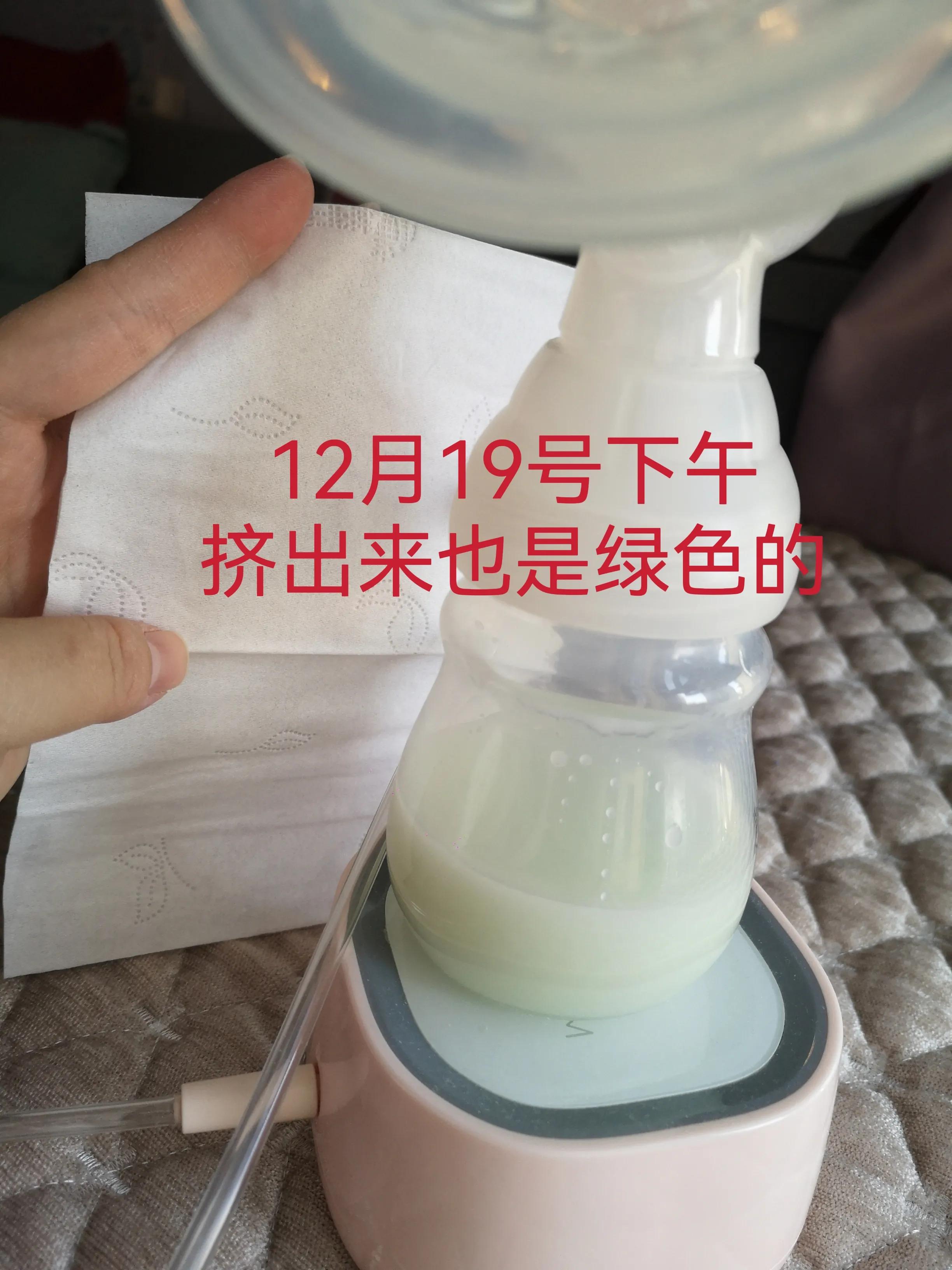 北京科兴新冠疫苗哺乳期可以打吗,焦虑症妈妈能不能母乳喂养