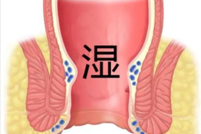 难以启齿的疾病是什么,难以启齿有痔疮怎么办
