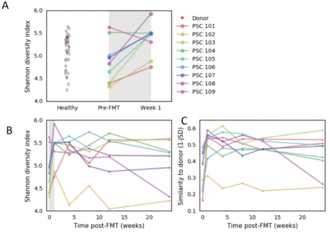 肠道菌群移植临床应用,肠道菌群移植治便秘吗
