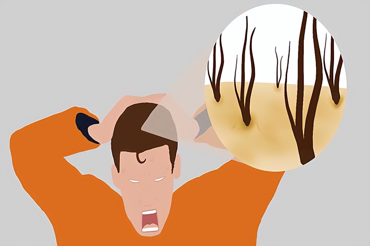 共存多年的虱子不见了？不长虱子头还痒？三点做好清爽头皮防脱发