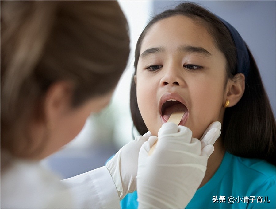 宝宝舌苔又厚又黄怎么回事,宝宝舌苔白又厚是什么原因