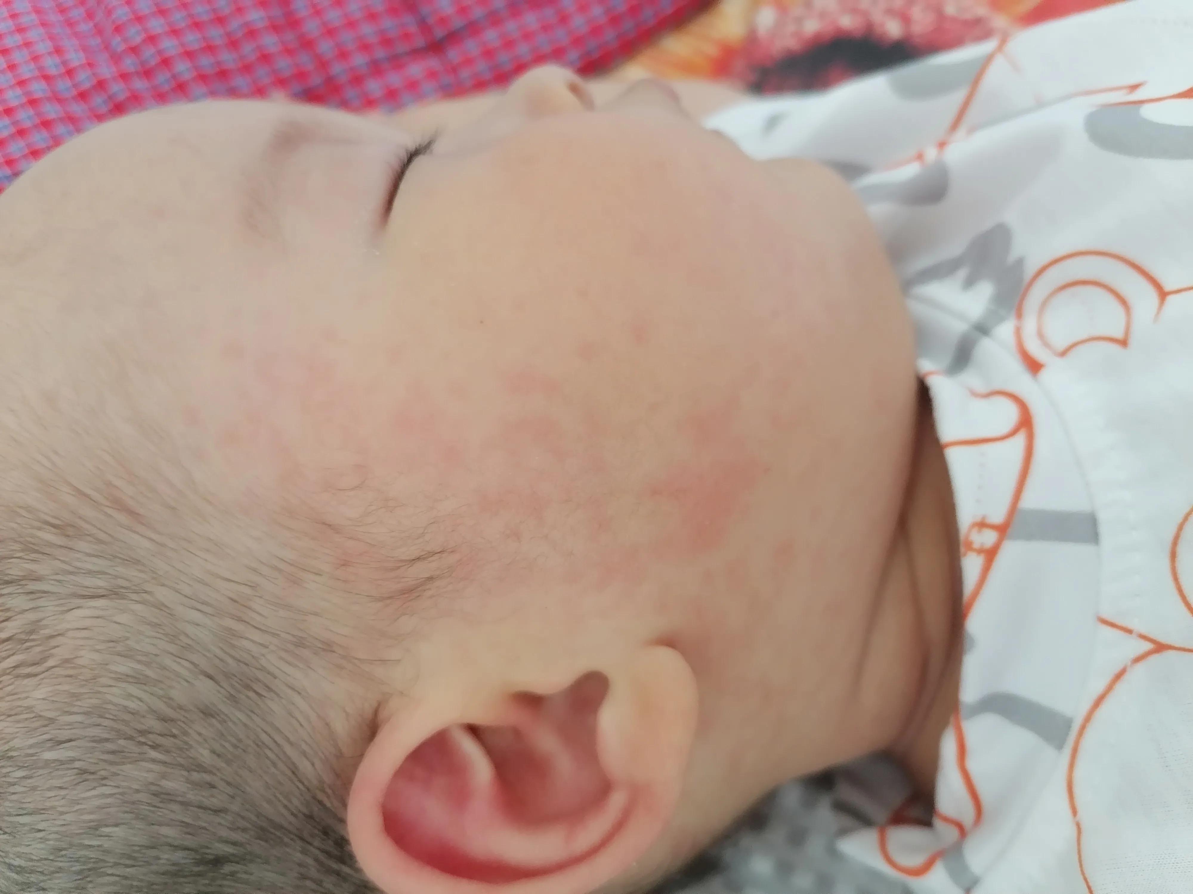 宝宝急疹一般几天痊愈,9个月宝宝幼儿急疹高热怎么喂药