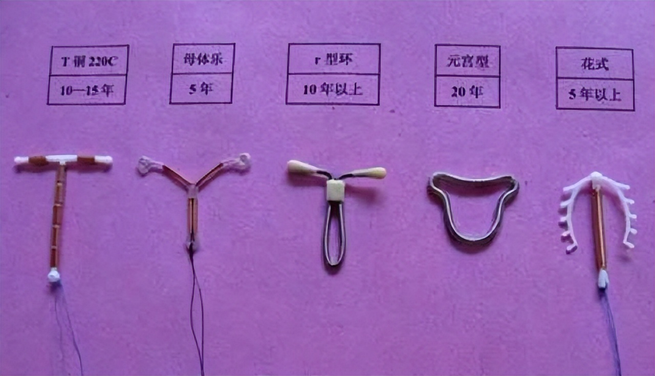 节育环在什么情况下会发生移位,节育环位置正常会引起妇科病吗