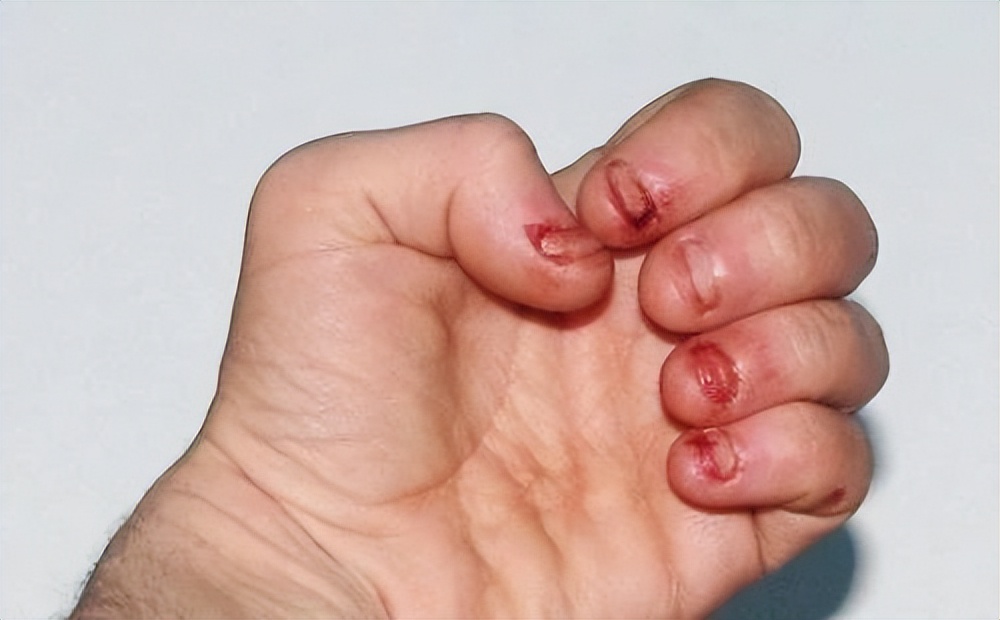 从小“咬指甲”的孩子，长大后怎么样了？一般逃不掉3种结局