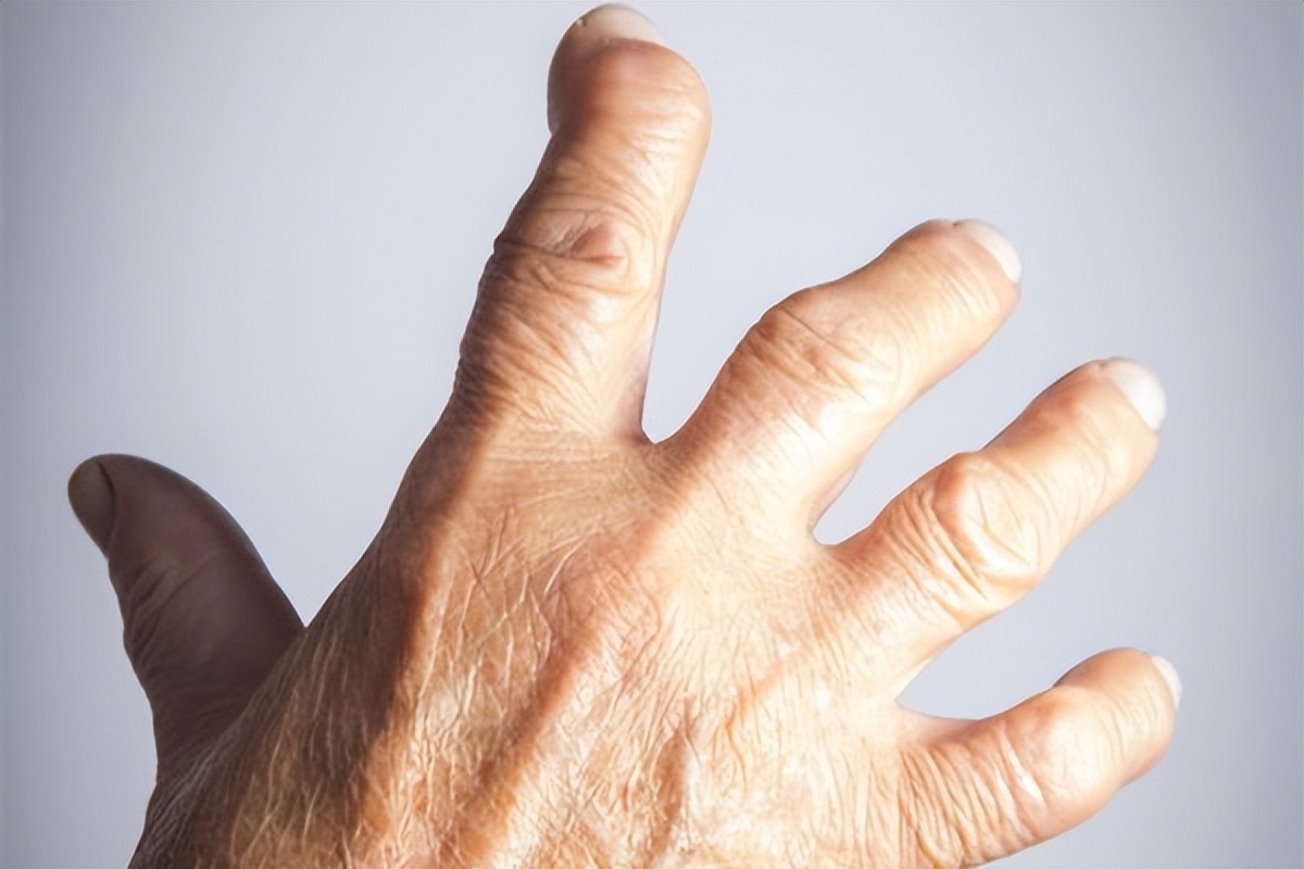 浑身关节疼是什么原因引起的,大关节疼痛是风湿还是类风湿