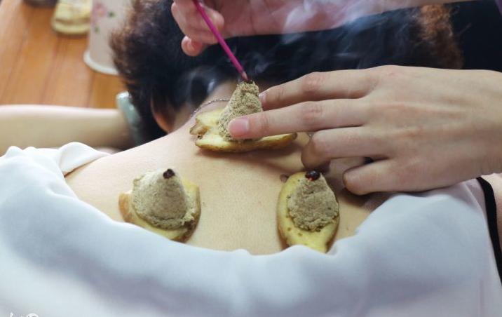 艾灸排病反应视频,艾灸时的各种灸感和排病反应