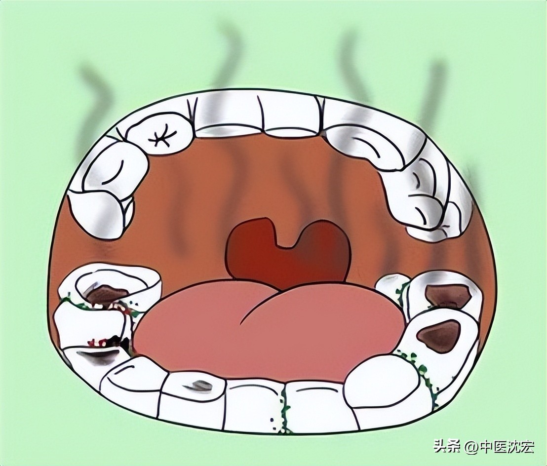 手心多汗症怎么彻底治愈,手心多汗症怎么解决