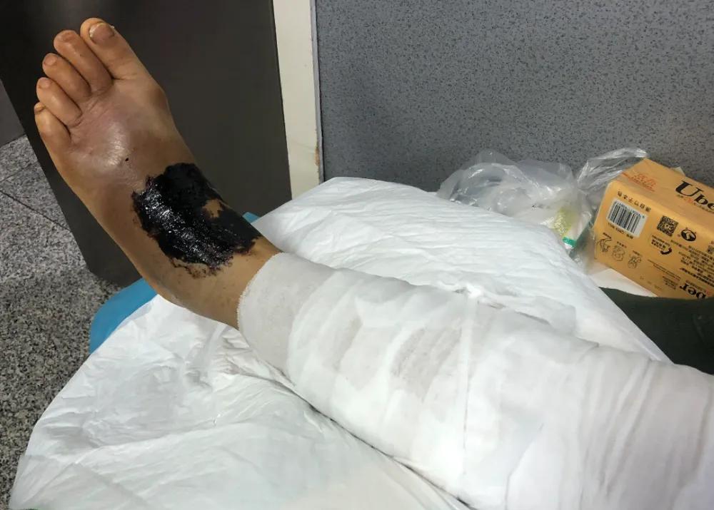 眼镜王蛇为什么不怕雄黄,眼镜王蛇为什么怕雄黄