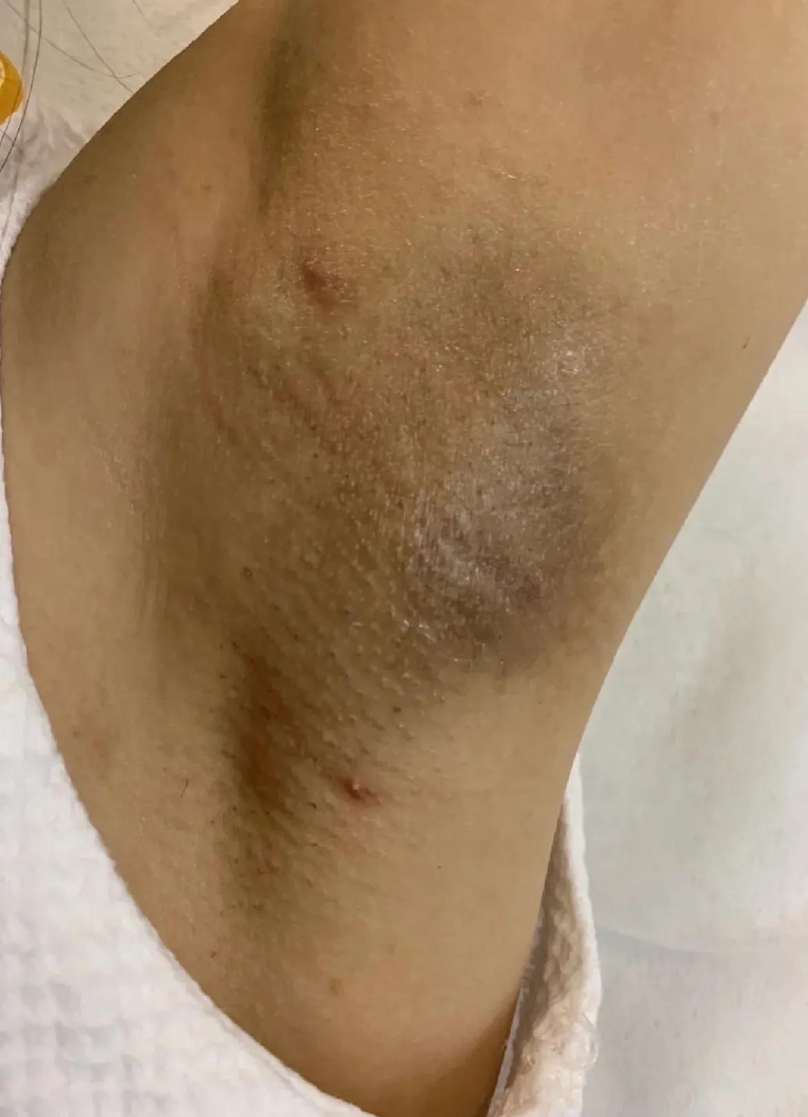 止汗露推荐测评祛狐臭平价,平价女士止汗露