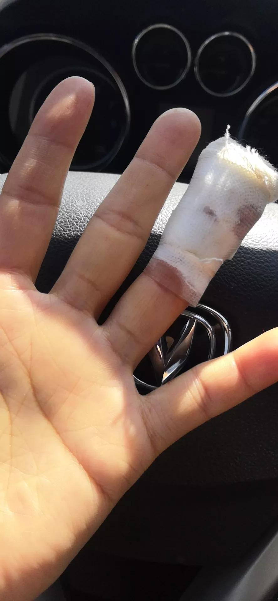 都是偷懒惹的祸,都是粗心大意惹的祸