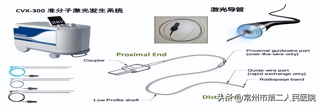 冠脉斑块钙化怎么治疗,冠脉斑块消融治疗