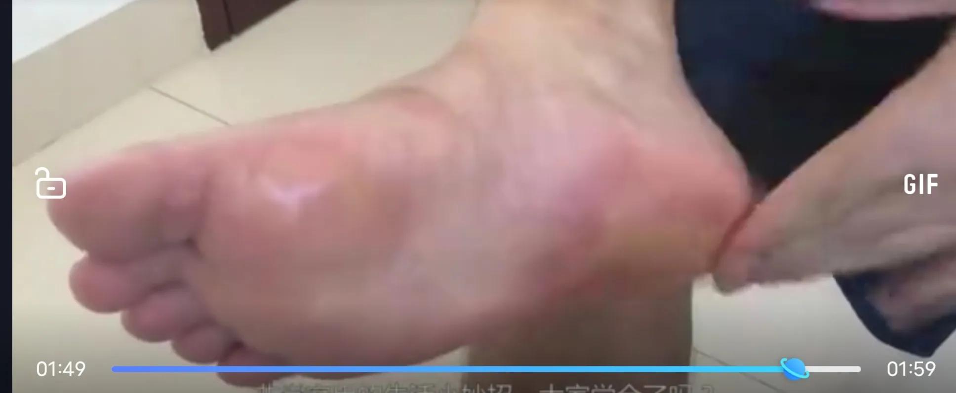 真正实用的省钱小妙招风油精,风油精过敏又红又痒妙招快速止痒