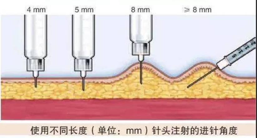 胰岛素针头直径规格的区别,胰岛素针头正确使用方法