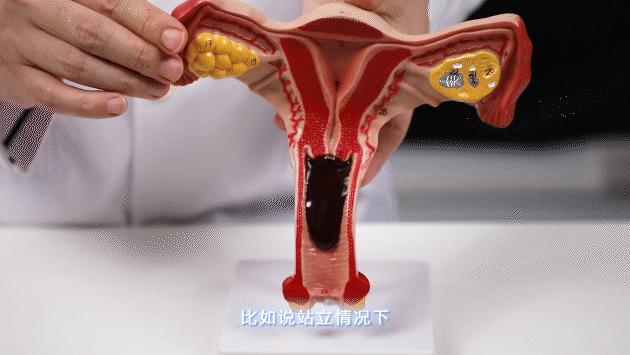 经血颜色辨别,经血到底什么颜色才算正常