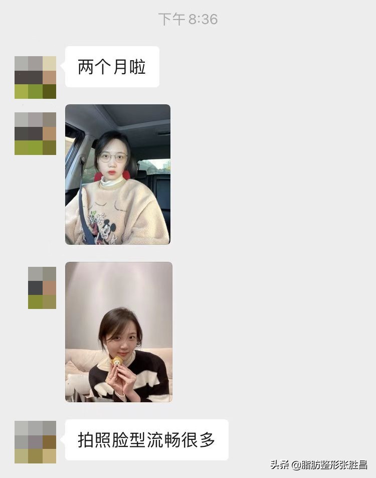 戴牙套矫正牙齿会有后遗症吗,女生28岁了建议矫正牙齿吗