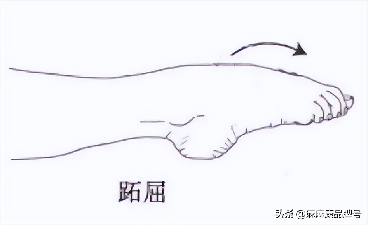 盆底肌电刺激与磁刺激的区别,什么是盆底磁刺激